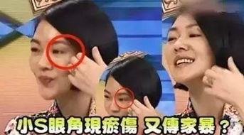 成源家暴爆料视频最新,真相揭露,受害者勇敢发声